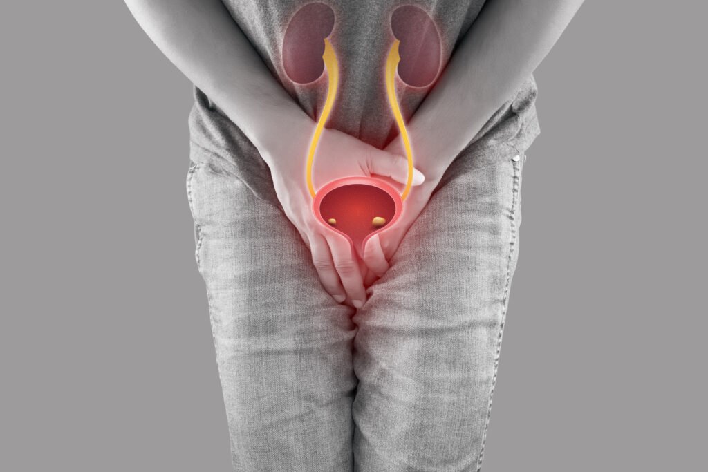 Female Urology Treatment in Delhi – Bladder Care by Dr Sunny Goel